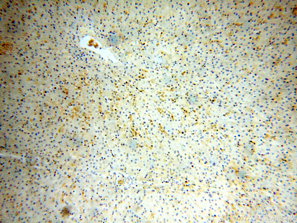 Immunohistochemistry (IHC) staining of human liver tissue using HBD Polyclonal antibody (16824-1-AP)