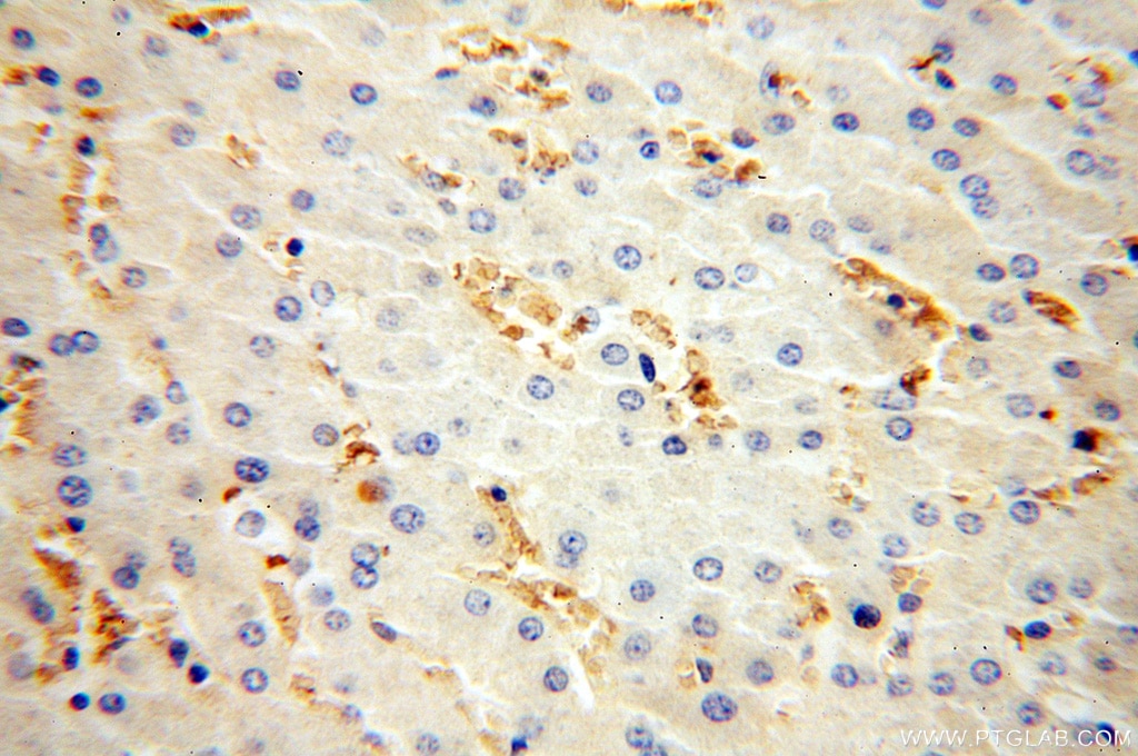 Immunohistochemistry (IHC) staining of human liver tissue using HBD Polyclonal antibody (16824-1-AP)