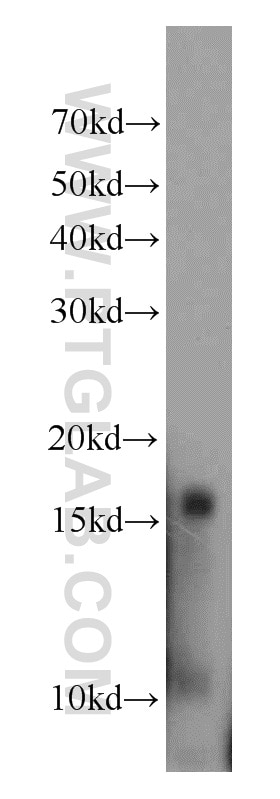 Western Blot (WB) analysis of human plasma using HBD Polyclonal antibody (16824-1-AP)