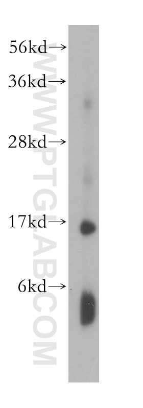 Western Blot (WB) analysis of human plasma using HBD Polyclonal antibody (16824-1-AP)