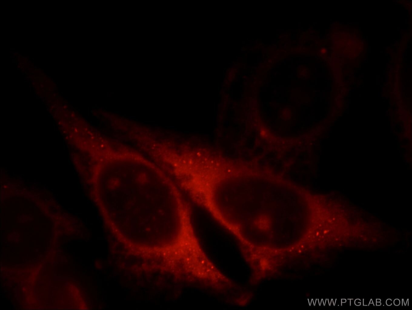 Hemoglobin Epsilon