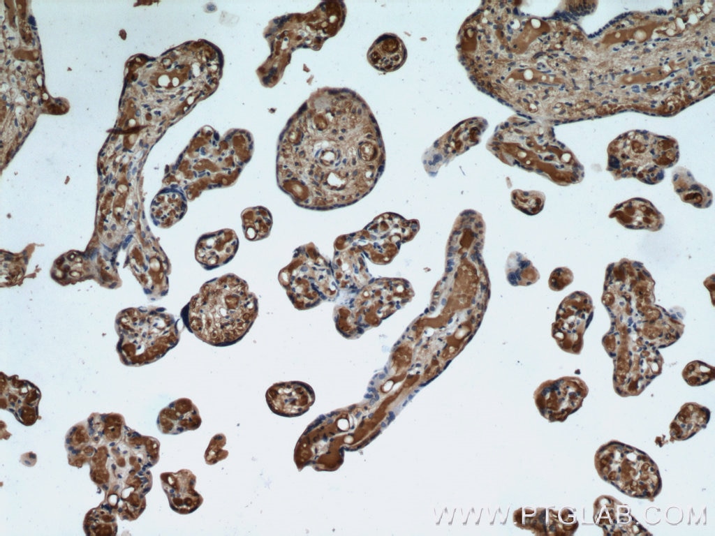 Immunohistochemistry (IHC) staining of human placenta tissue using Hemoglobin Epsilon Polyclonal antibody (12361-1-AP)