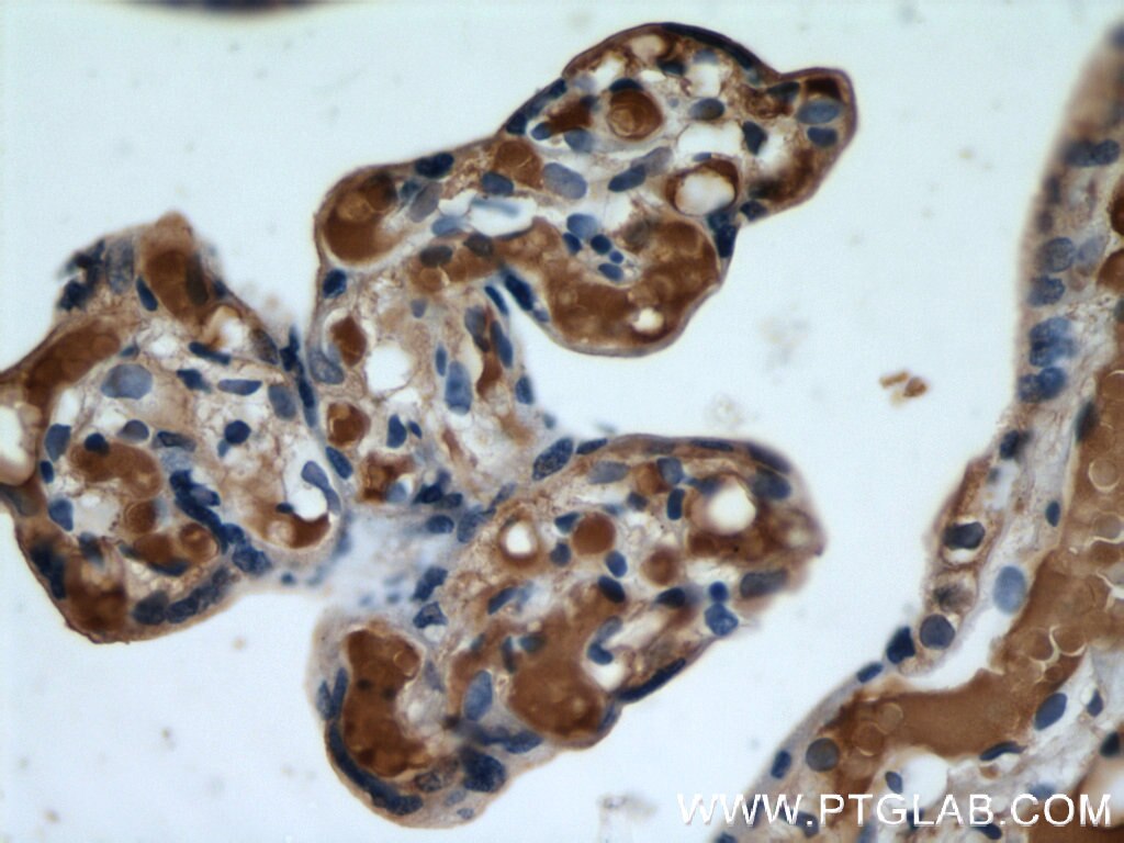 Immunohistochemistry (IHC) staining of human placenta tissue using Hemoglobin Epsilon Polyclonal antibody (12361-1-AP)