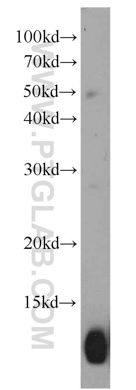 WB analysis of human placenta using 12361-1-AP