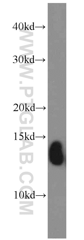 Western Blot (WB) analysis of human placenta tissue using Hemoglobin Epsilon Polyclonal antibody (12361-1-AP)