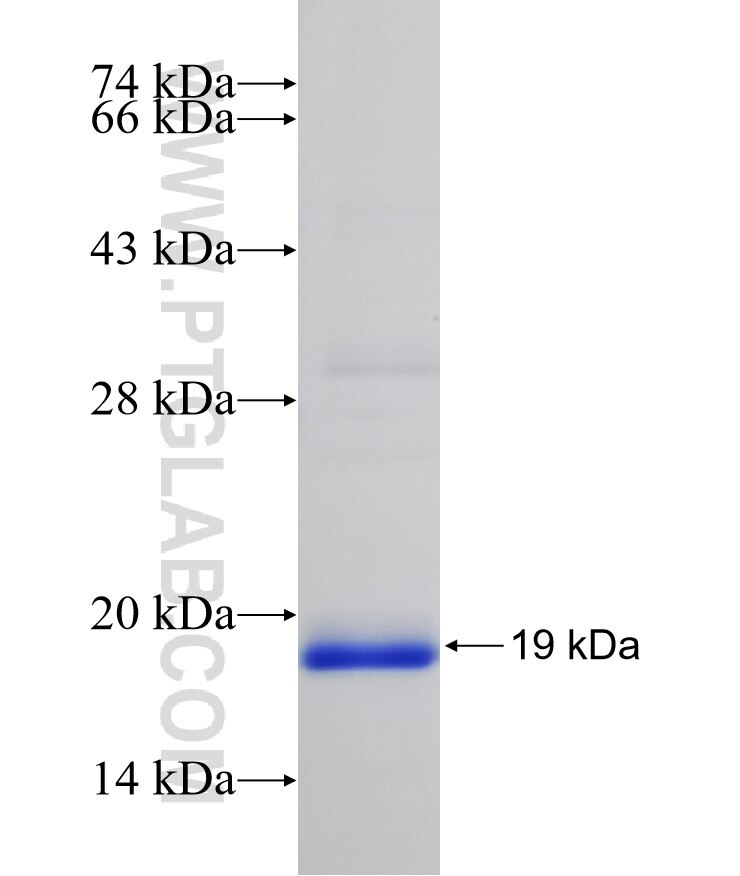 HBE1 fusion protein Ag19300 SDS-PAGE