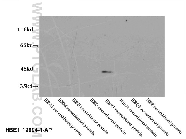 Western Blot (WB) analysis of recombinant protein using HBE1-Specific Polyclonal antibody (19994-1-AP)
