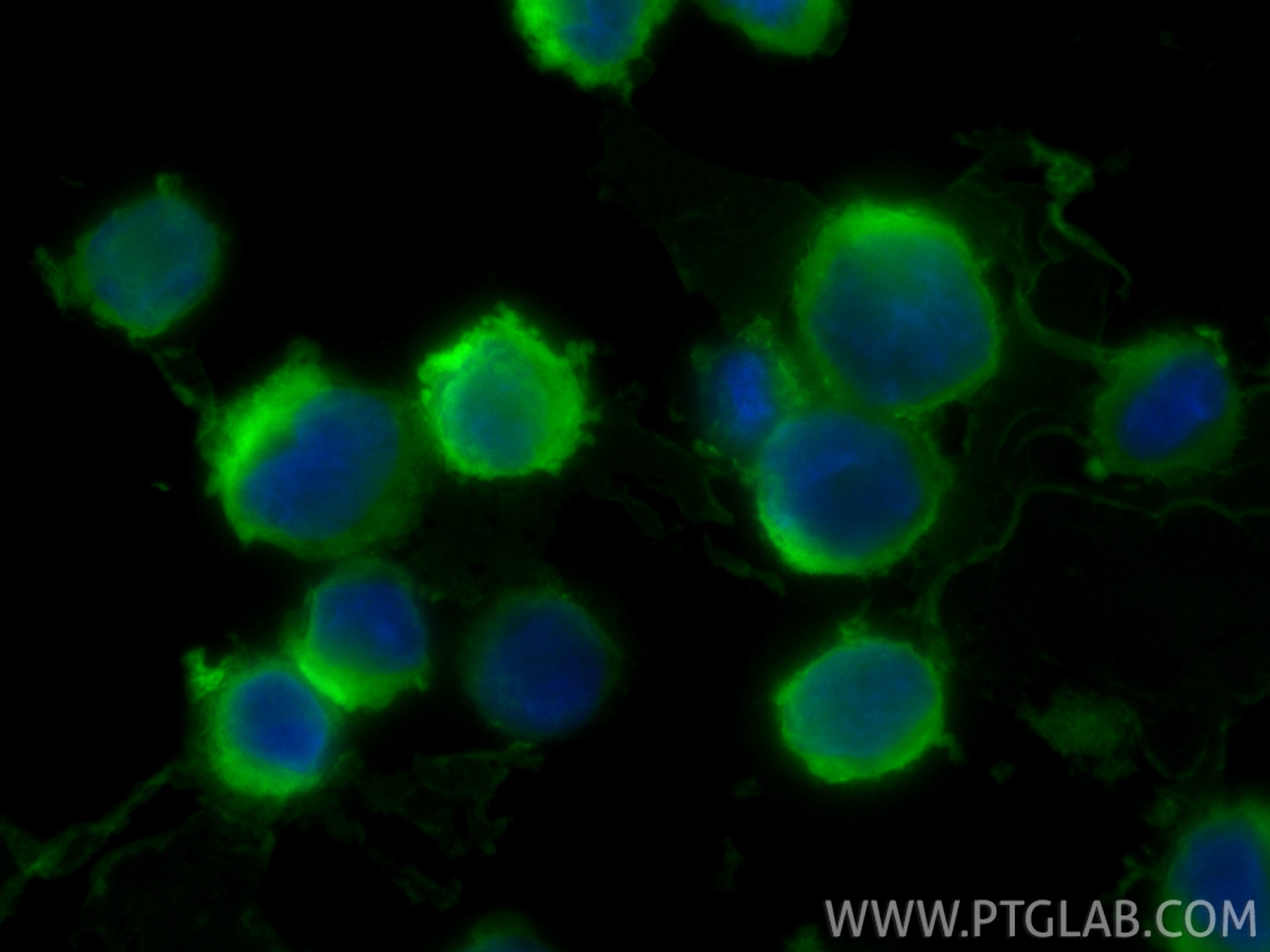 Immunofluorescence (IF) / fluorescent staining of K-562 cells using HBG1 Polyclonal antibody (25728-1-AP)