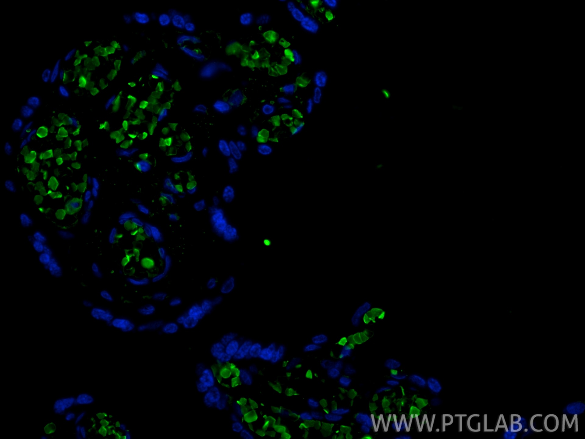 IF Staining of human placenta using 25728-1-AP Immunofluorescence (IF) / fluorescent staining of human placenta tissue using HBG1 Polyclonal antibody (25728-1-AP)