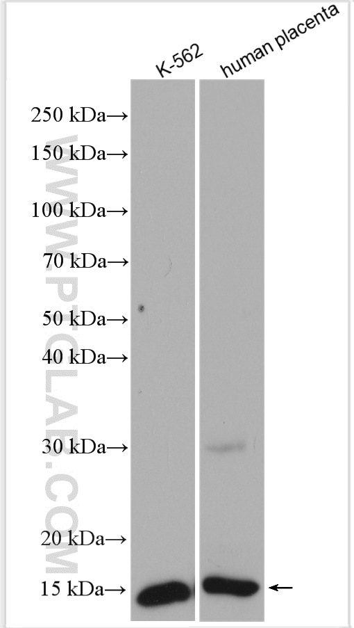 Western Blot (WB) analysis of various lysates using HBG1 Polyclonal antibody (25728-1-AP)