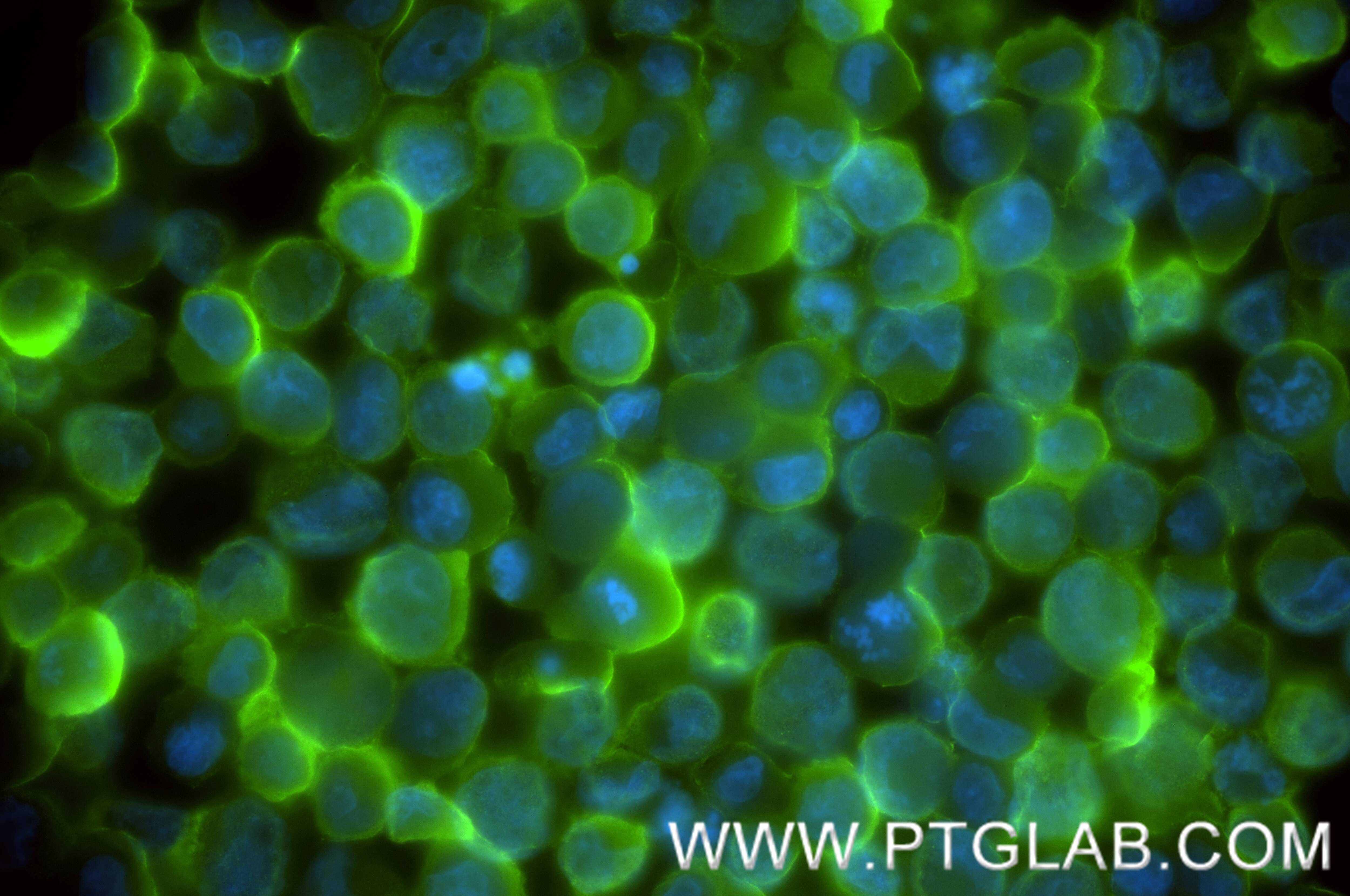IF Staining of K-562 using 86851-1-RR (same clone as 86851-1-PBS) Immunofluorescence (IF) / fluorescent staining of K-562 cells using HBG1 Recombinant monoclonal antibody (86851-1-RR)