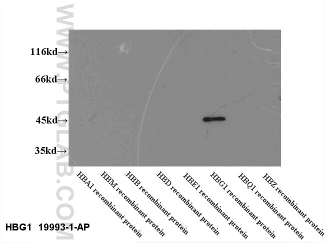 Western Blot (WB) analysis of recombinant proein using HBG1/2-Specific Polyclonal antibody (19993-1-AP)