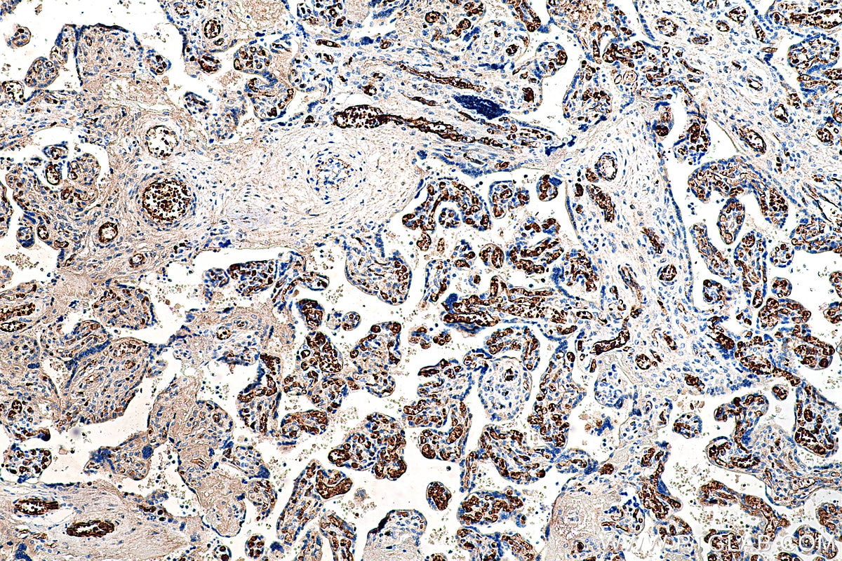 IHC staining of human placenta using 66168-1-Ig