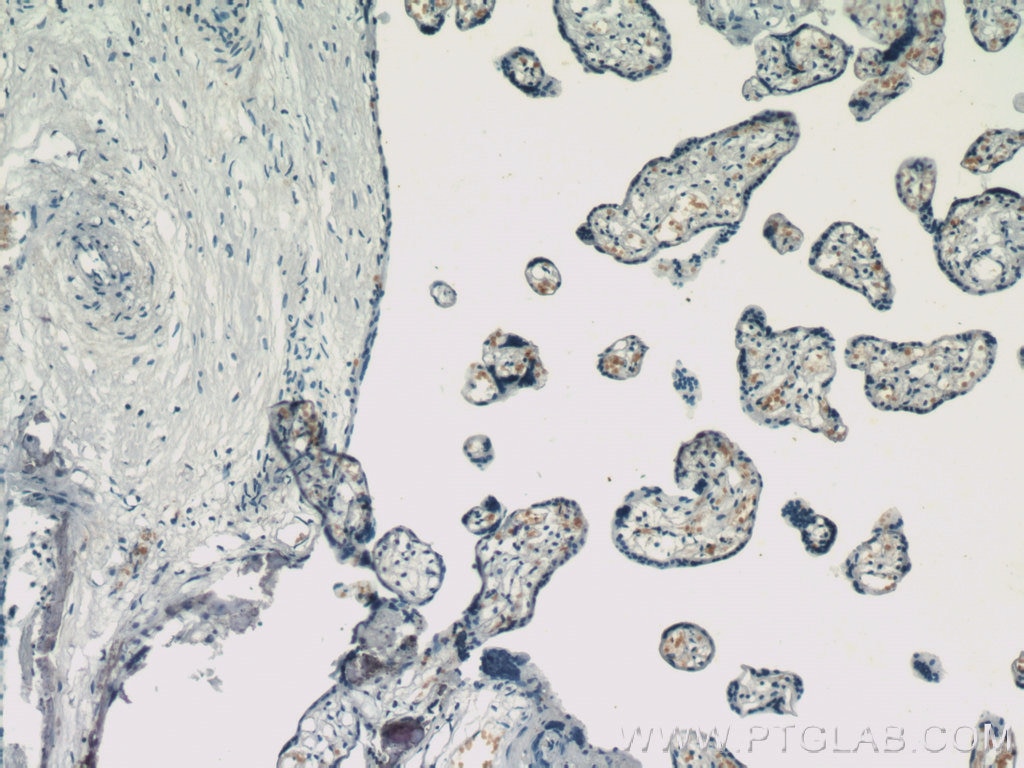 Immunohistochemistry (IHC) staining of human placenta tissue using HBG1/2-Specific Monoclonal antibody (66168-1-Ig)