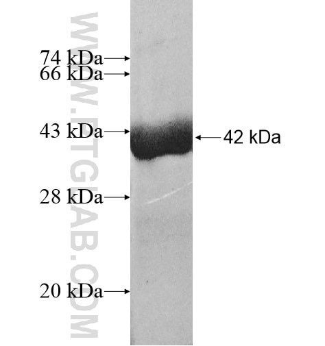 HBM fusion protein Ag11948 SDS-PAGE