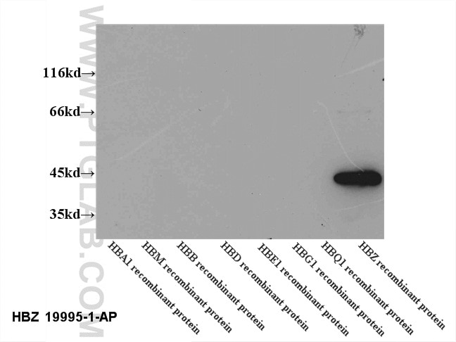 Western Blot (WB) analysis of recombinant protein using HBZ-Specific Polyclonal antibody (19995-1-AP)