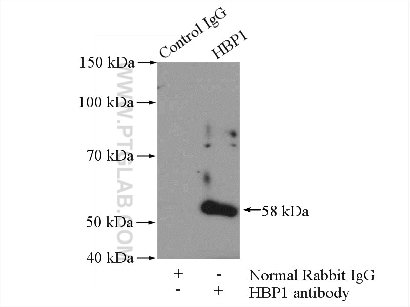 Immunoprecipitation (IP) experiment of mouse brain tissue using HBP1 Polyclonal antibody (11746-1-AP)