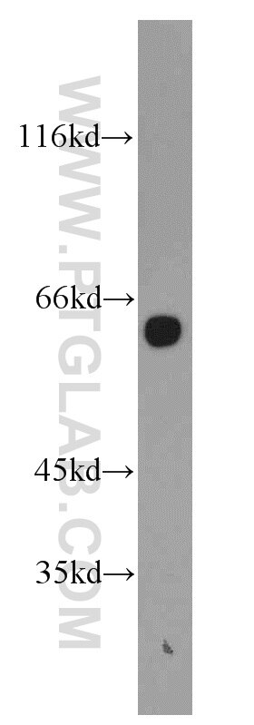 Western Blot (WB) analysis of human brain tissue using HBP1 Polyclonal antibody (11746-1-AP)