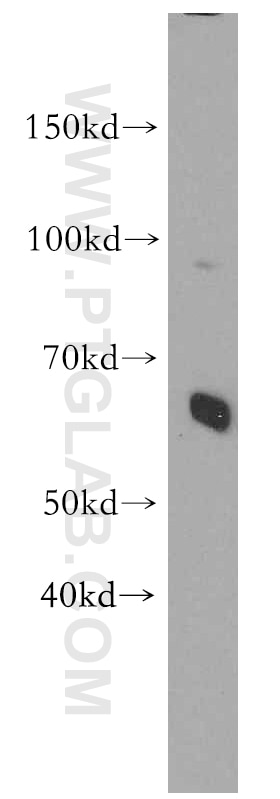 Western Blot (WB) analysis of human brain tissue using HBP1 Polyclonal antibody (11746-1-AP)