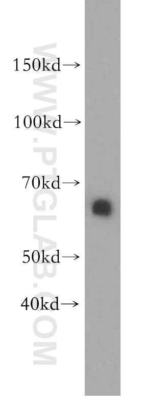 Western Blot (WB) analysis of human brain tissue using HBP1 Polyclonal antibody (11746-1-AP)