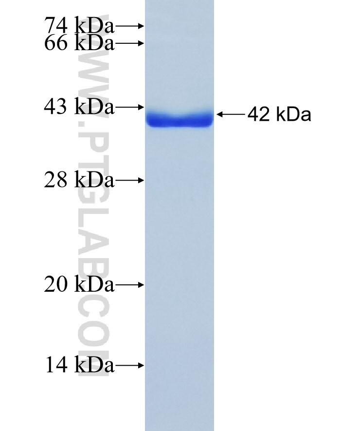 HBP1 fusion protein Ag37531 SDS-PAGE HBP1 fusion protein Ag37531 SDS-PAGE