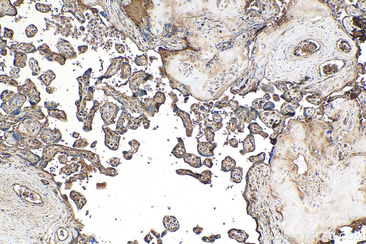 IHC staining of human placenta using 16706-1-AP