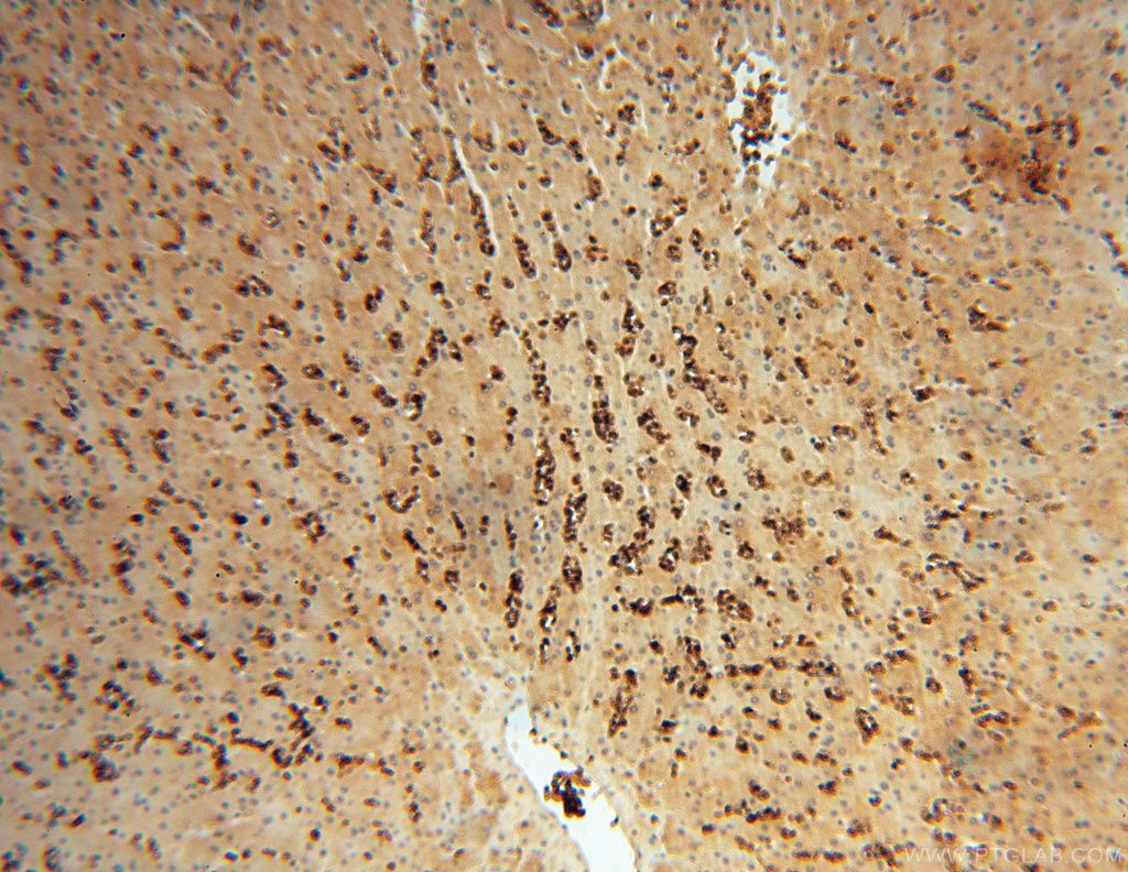 Immunohistochemistry (IHC) staining of human liver tissue using HBQ1 Polyclonal antibody (16706-1-AP)