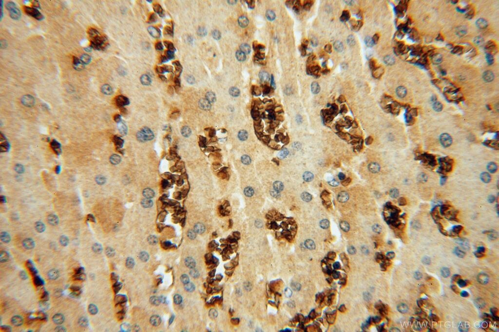 Immunohistochemistry (IHC) staining of human liver tissue using HBQ1 Polyclonal antibody (16706-1-AP)