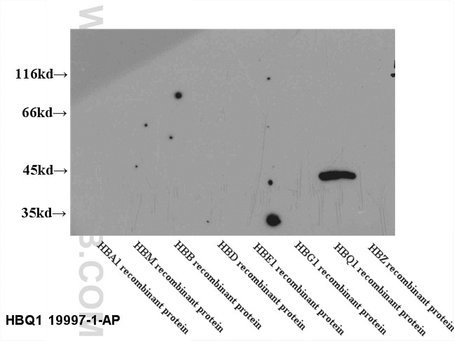 Western Blot (WB) analysis of recombinant protein using HBQ1-Specific Polyclonal antibody (19997-1-AP)