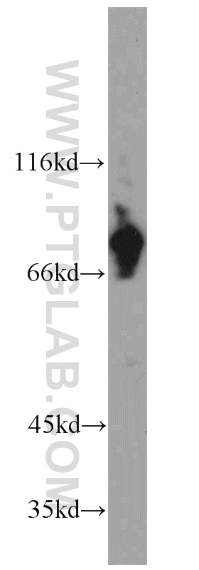 Western Blot (WB) analysis of A2780 cells using HBS1L Polyclonal antibody (10359-1-AP)