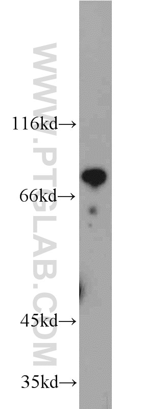 Western Blot (WB) analysis of Jurkat cells using HBS1L Polyclonal antibody (10359-1-AP)