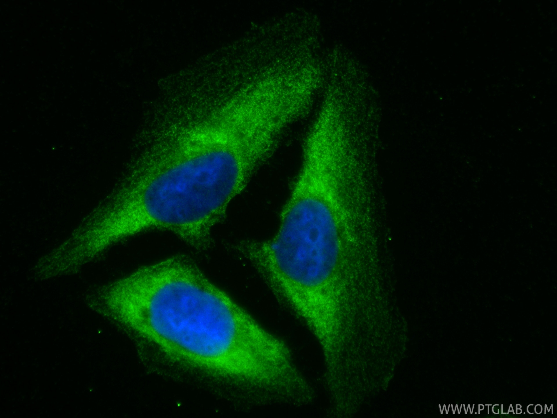 Immunofluorescence (IF) / fluorescent staining of U2OS cells using HBS1L Monoclonal antibody (68146-1-Ig) Immunofluorescence (IF) / fluorescent staining of U2OS cells using HBS1L Monoclonal antibody (68146-1-Ig)