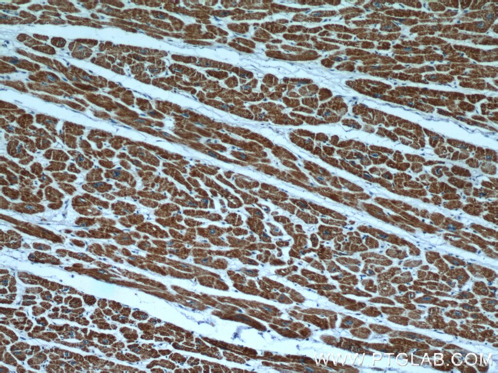 Immunohistochemistry (IHC) staining of human heart tissue using HBXIP Polyclonal antibody (14492-1-AP)