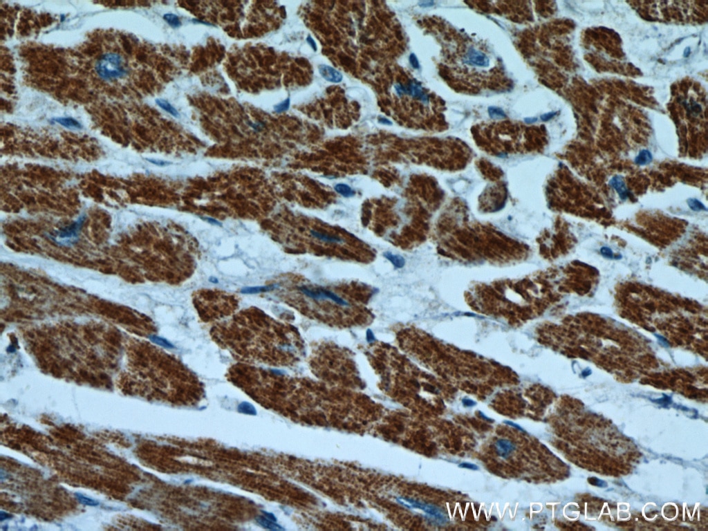 Immunohistochemistry (IHC) staining of human heart tissue using HBXIP Polyclonal antibody (14492-1-AP)