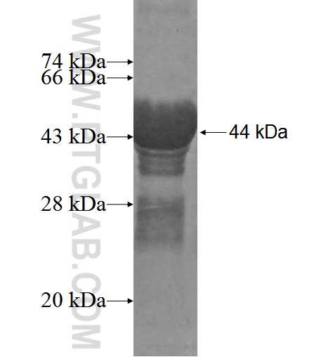 HBXIP fusion protein Ag5894 SDS-PAGE