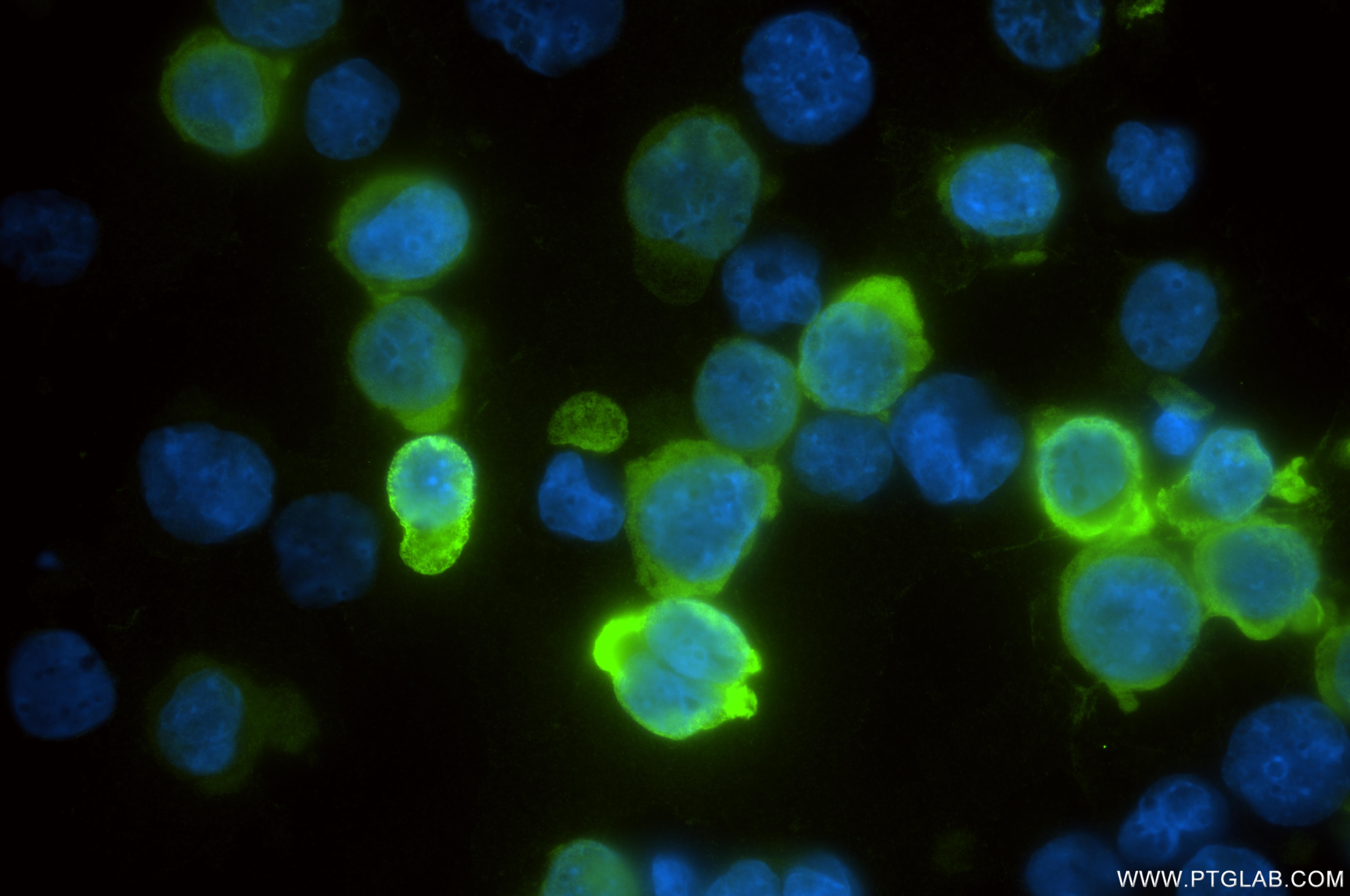 Immunofluorescence (IF) / fluorescent staining of K-562 cells using HBZ Recombinant monoclonal antibody (86879-3-RR)