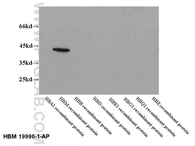 Western Blot (WB) analysis of recombinant protein using HBM-Specific Polyclonal antibody (19996-1-AP)