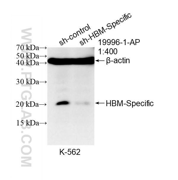 Western Blot (WB) analysis of K-562 cells using HBM-Specific Polyclonal antibody (19996-1-AP)