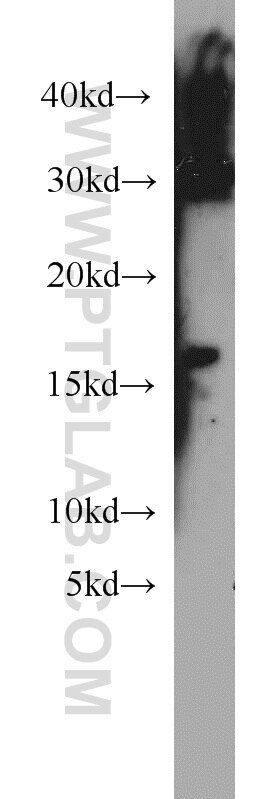 Western Blot (WB) analysis of human heart tissue using HBM-Specific Polyclonal antibody (19996-1-AP)