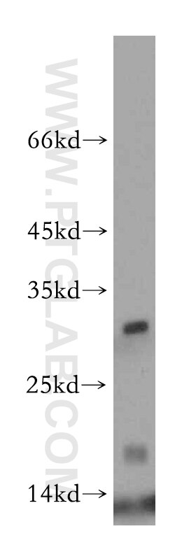 Western Blot (WB) analysis of human heart tissue using HBM-Specific Polyclonal antibody (19996-1-AP)