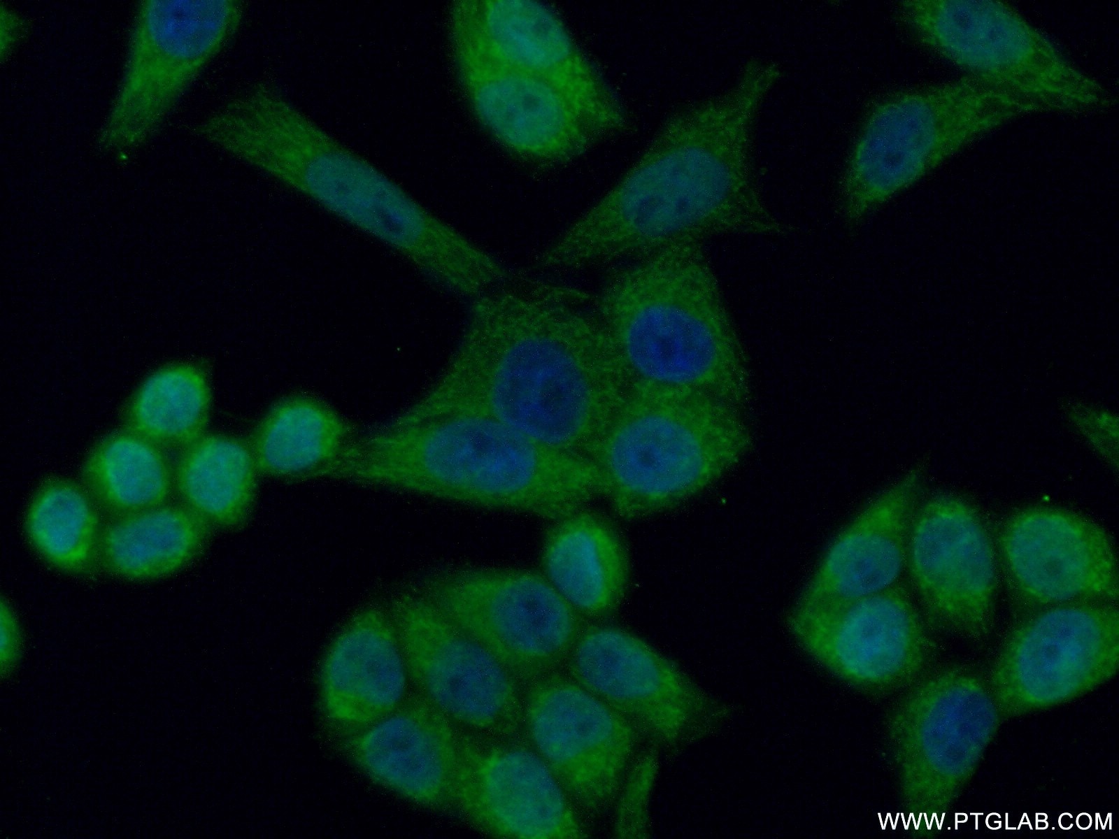 Immunofluorescence (IF) / fluorescent staining of HeLa cells using HCCS Polyclonal antibody (15118-1-AP)