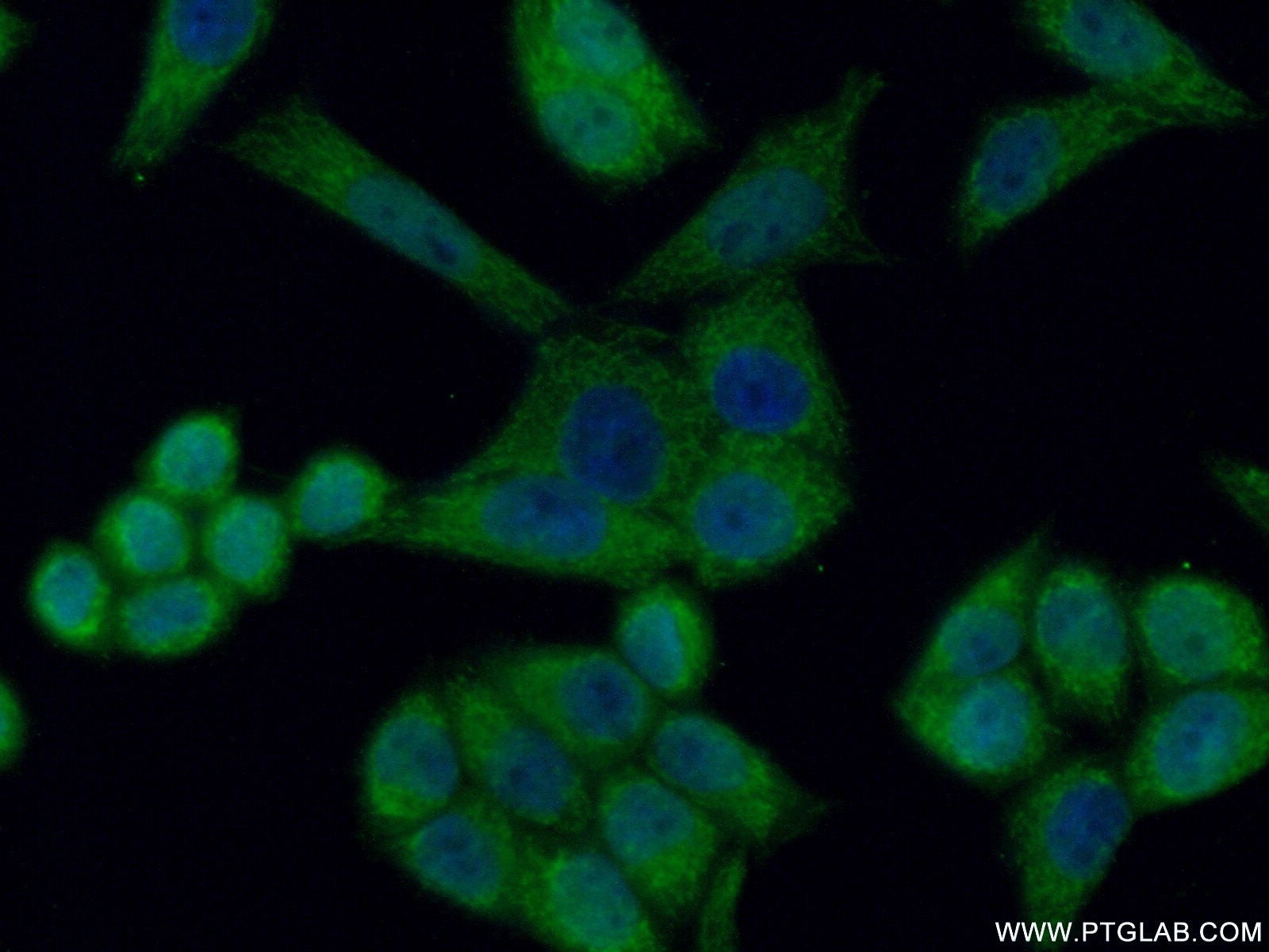 IF Staining of HeLa using 15118-1-AP