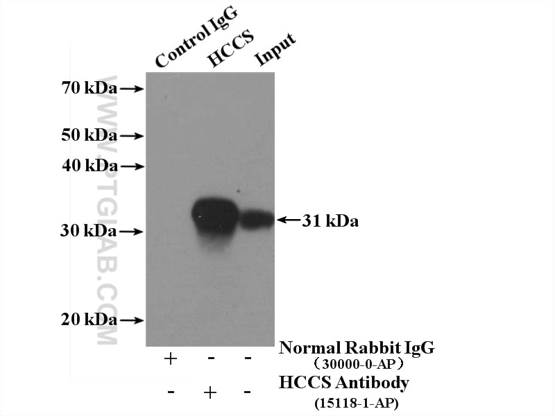 Immunoprecipitation (IP) experiment of MCF-7 cells using HCCS Polyclonal antibody (15118-1-AP)