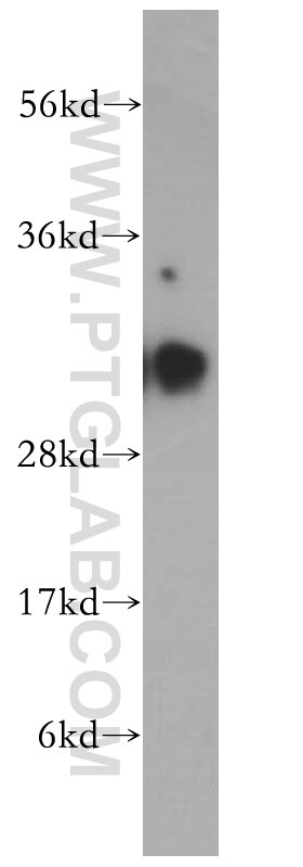 Western Blot (WB) analysis of MCF-7 cells using HCCS Polyclonal antibody (15118-1-AP)