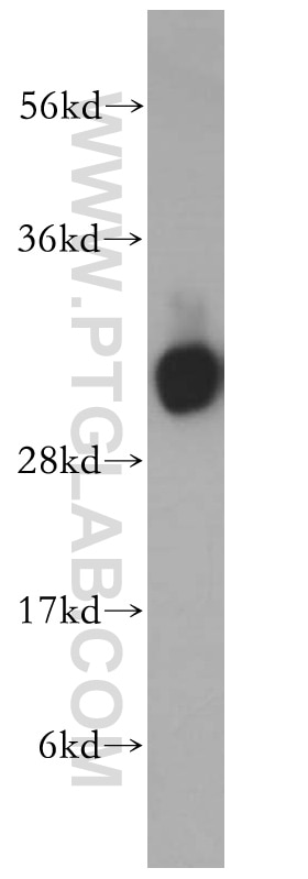 Western Blot (WB) analysis of HeLa cells using HCCS Polyclonal antibody (15118-1-AP)