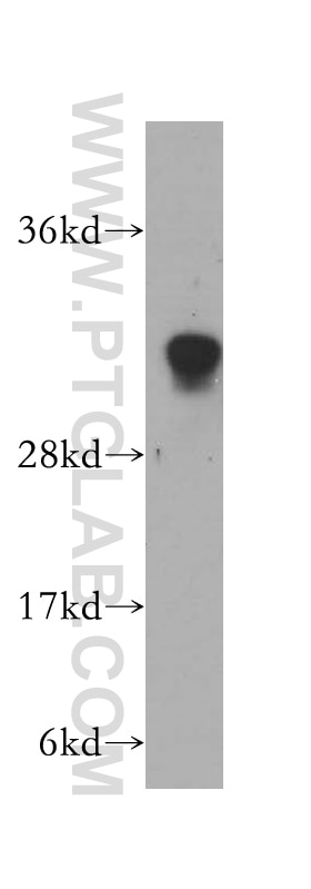 Western Blot (WB) analysis of human heart tissue using HCCS Polyclonal antibody (15118-1-AP)