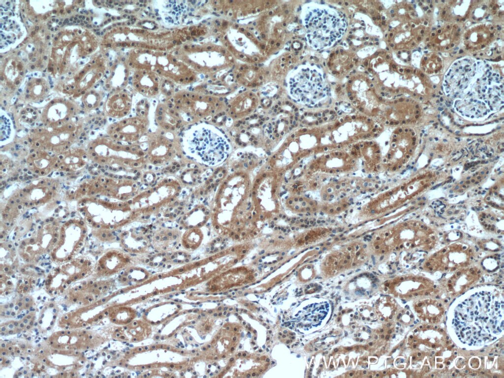 Immunohistochemistry (IHC) staining of human kidney tissue using HCFC1 Polyclonal antibody (19358-1-AP)