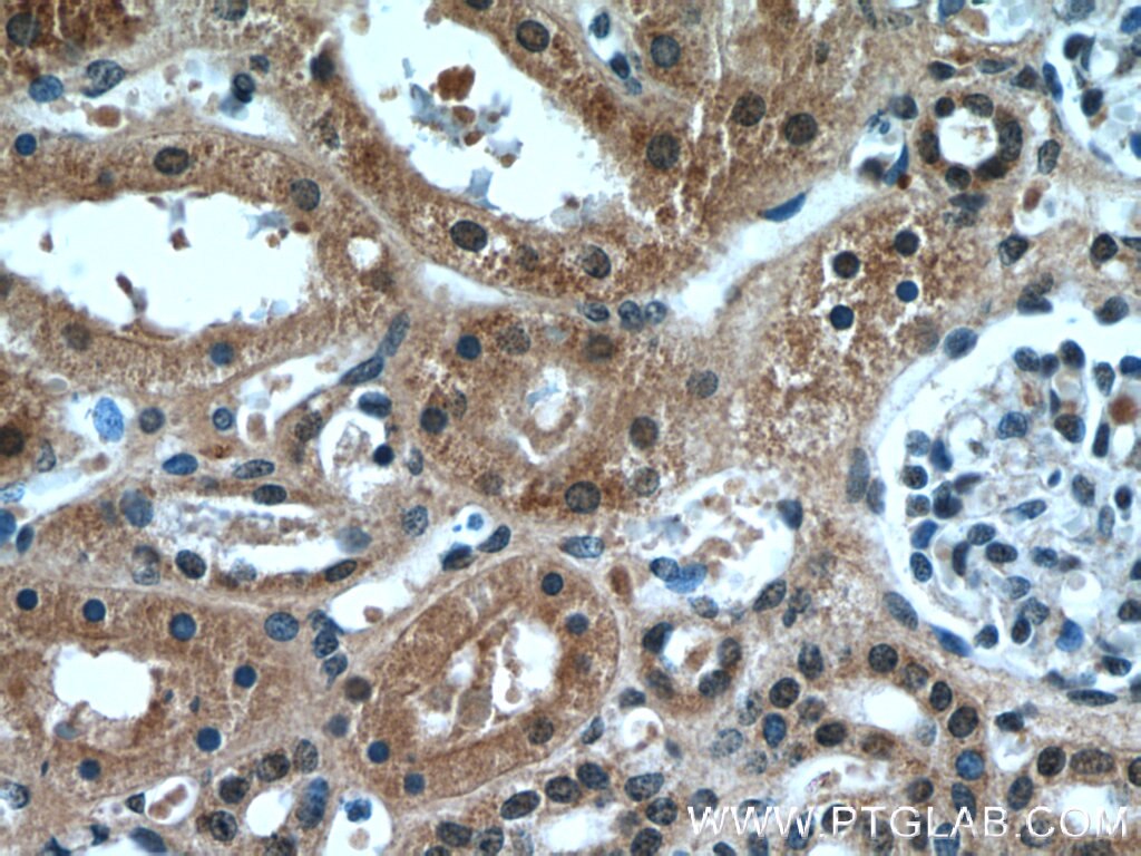 Immunohistochemistry (IHC) staining of human kidney tissue using HCFC1 Polyclonal antibody (19358-1-AP)