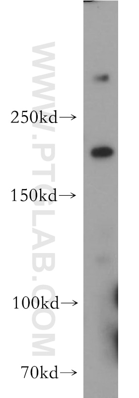 Western Blot (WB) analysis of HEK-293 cells using HCFC1 Polyclonal antibody (19358-1-AP)