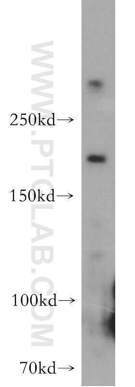 Western Blot (WB) analysis of A431 cells using HCFC1 Polyclonal antibody (19358-1-AP)